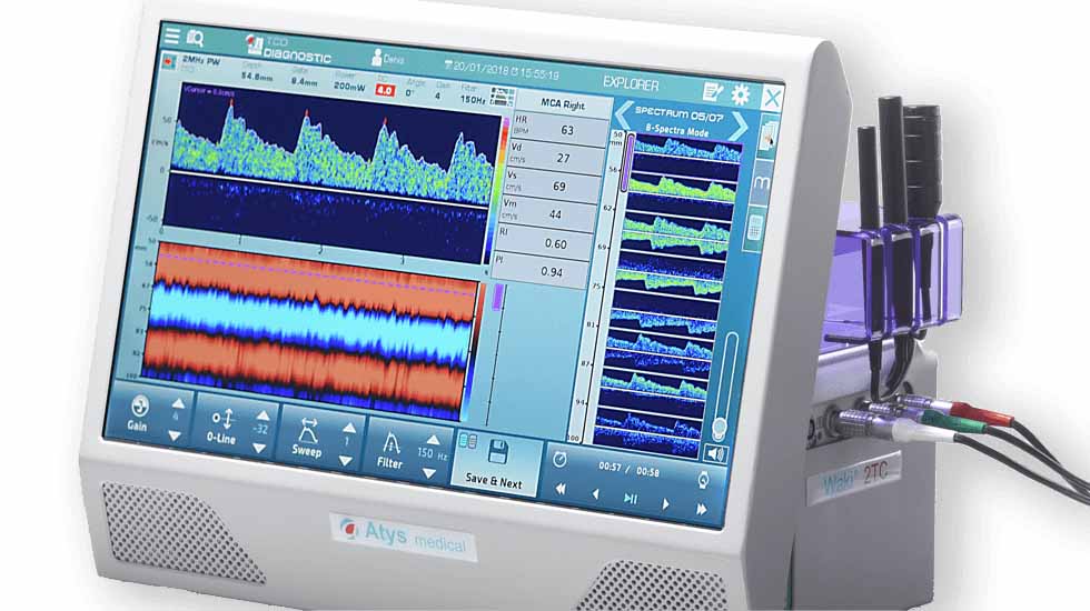 Transcraniële Doppler TCD WAKIe