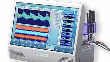 Transcraniële Doppler TCD WAKIe